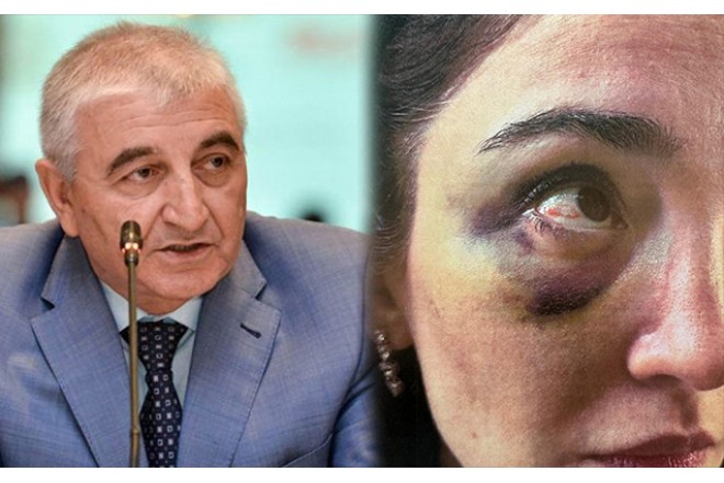 Məzahir Pənahovun oğlu arvadına işgəncə verib ?