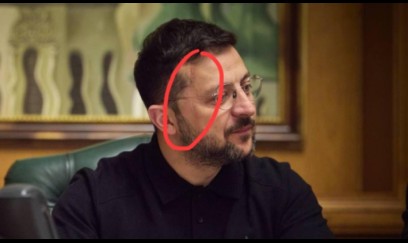 Zelenskinin üzünə nə olub? - FOTO