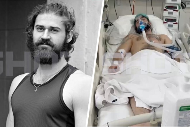 Dayaz suya kəllə vuran turist komaya düşdü 