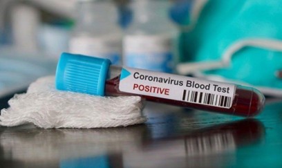 Çində koronavirusa yoluxma iki dəfə ARTDI