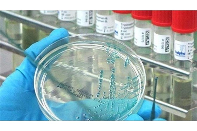 Alimlər təhlükəli virus tapdılar: Pandemiya olacaqmı?