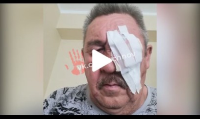 Sərnişinlər avtobus sürücüsünün gözünü çıxardılar -VİDEO
