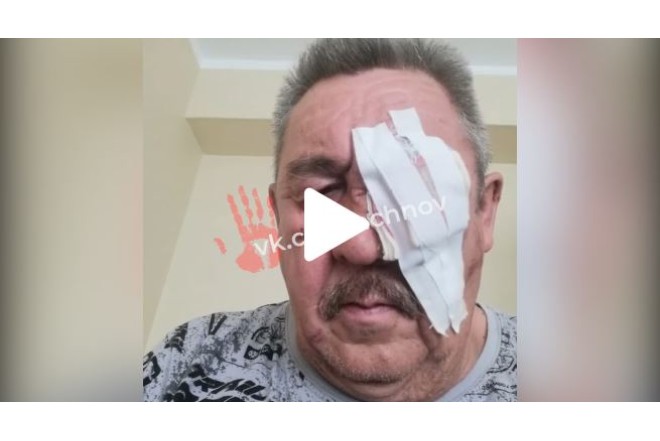 Sərnişinlər avtobus sürücüsünün gözünü çıxardılar -VİDEO