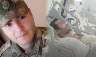 81 gün komada qalandan sonra vəfat etdi - “tükdönmə” əməliyyatı... + VİDEO