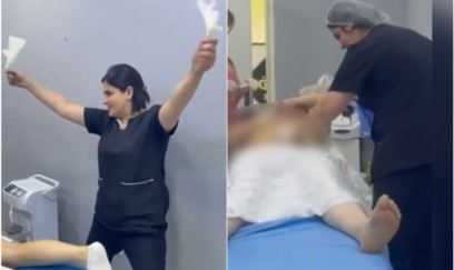 Prokurorluq sosial şəbəkələrdə estetik əməliyyat proseduru ilə bağlı yayılan görüntünü araşdırır 