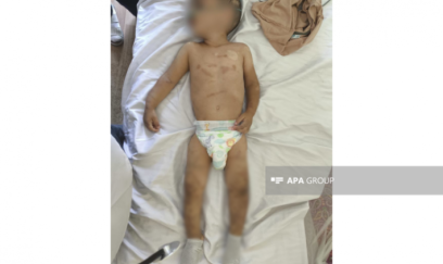 Ağdamda atası tərəfindən döyüldüyü iddia edilən iki yaşlı körpə xəstəxanaya yerləşdirilib 