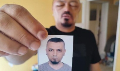 İnternetdən aldığı şampun həyatını kabusa çevirdi - FOTO