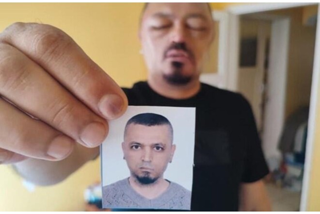 İnternetdən aldığı şampun həyatını kabusa çevirdi - FOTO