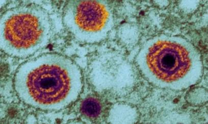 Alimlər yeni təhlükəli virus aşkarlayıblar 