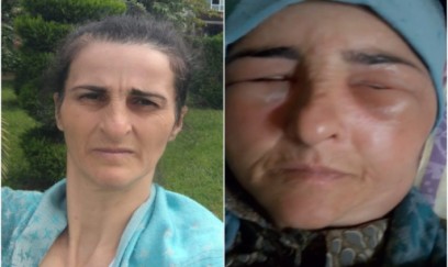 Lənkəranda qonşular arasında dava - xəsarət alan var 
