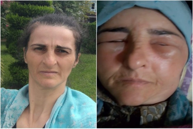 Lənkəranda qonşular arasında dava - xəsarət alan var 