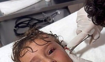 Meksikada uşağın qulağından canlı xərçəng çıxarıldı