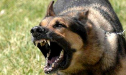 Öldürülən kişinin həmin it tərəfindən əvvəllər də hücuma uğradığı məlum oldu