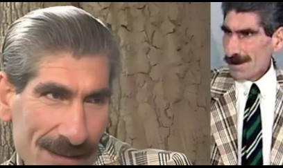 İllər sonra aktyor tanınmaz hala düşdü - FOTO