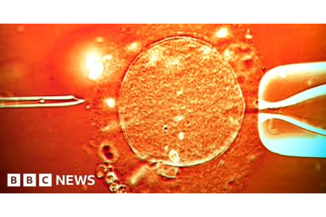 "Bizdə  ərləri aldadıb arvadlarını anonim donorlardan doğuzdururlar"- Hüquqşünasdan SENSASİON AÇIQLAMA