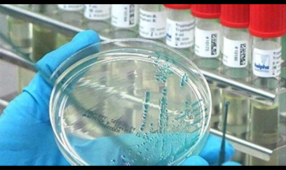 ÜST xəbərdarlıq etdi: Bu virus sürətlə yayılır!