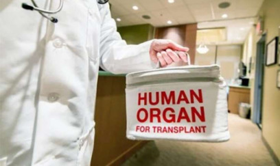 Təhsil eksperti orqanlarını bağışladı 