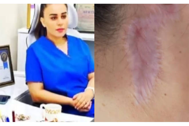 “Məni gözəllik salonunda əməliyyat etdi, ağzım əyilir” - VİDEO