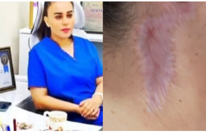 “Məni gözəllik salonunda əməliyyat etdi, ağzım əyilir” - VİDEO