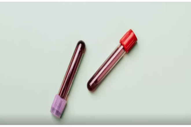 Alimlər təəccüblənirlər - Bu qan qrupundan olanlar uzunömürlü olurlar