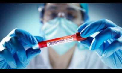 Virus təhlükəsi azdır, təşvişə ehtiyac yoxdur