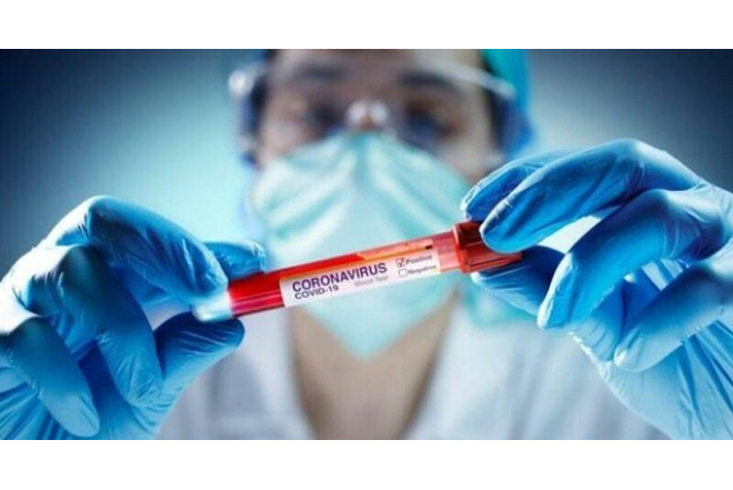 Virus təhlükəsi azdır, təşvişə ehtiyac yoxdur