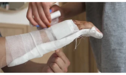 "Travmalarda gips hər zaman tətbiq olunmur" - Həkim açıqladı