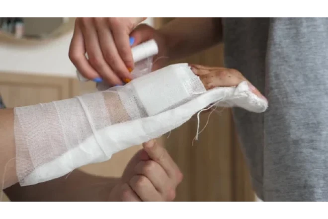 "Travmalarda gips hər zaman tətbiq olunmur" - Həkim açıqladı