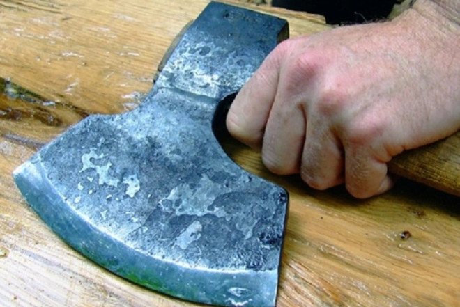 Balta ilə xəsarət yetirilənlər məlum olub, SAXLANILAN VAR