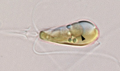 Dünyada “yeni həyat forması” üçüncü dəfə qeydə alındı 