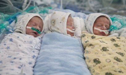 “Sumqayıt Hospital”da üçəm qardaşlar doğuldu - Foto