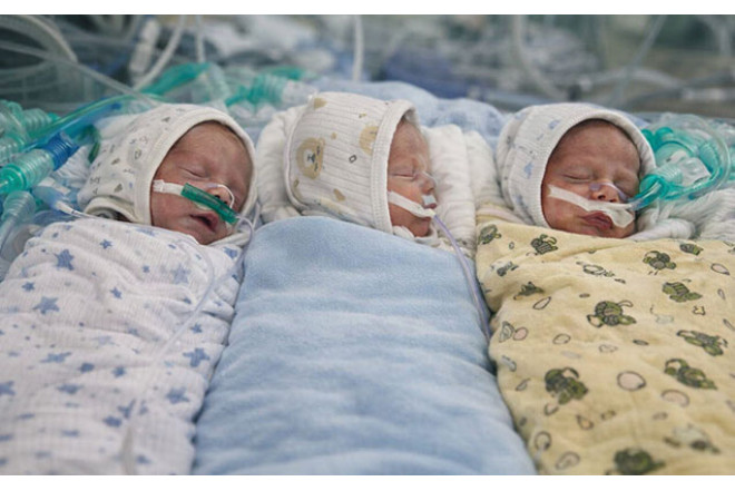 “Sumqayıt Hospital”da üçəm qardaşlar doğuldu - Foto