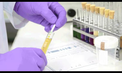 Narkoloji xəstələrlə bağlı işə qəbul qaydaları sərtləşdirilir 