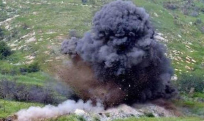 Minaya düşən şəxsin ayağı amputasiya edildi 