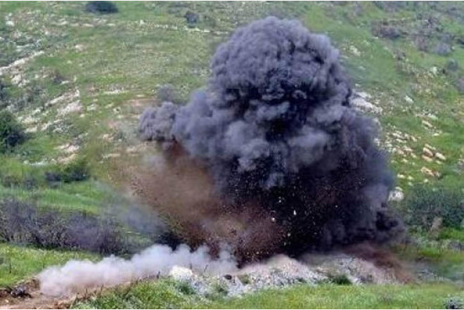 Minaya düşən şəxsin ayağı amputasiya edildi 