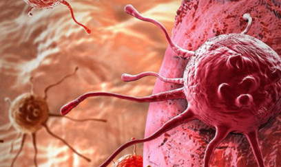 Xərçənglə bağlı çağırış 