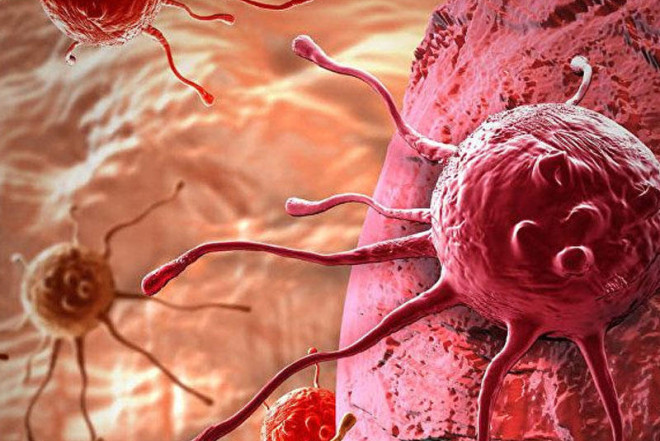 Xərçənglə bağlı çağırış 