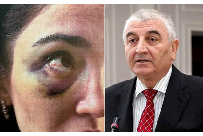 Məzahir Pənahovun keçmiş gəlinindən şikayət: " Zinət əşyalarımı qaytarmırlar"