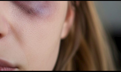 Bakıda aktyorun anası döyüldü - TƏFƏRRÜAT