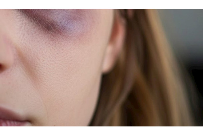 Bakıda aktyorun anası döyüldü - TƏFƏRRÜAT