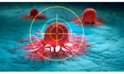 Xərçəngin müalicəsində İNQİLAB- 90 faiz dəqiqliklə test edilir