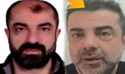 Estetik əməliyyatlarla 7 il gizlənə bildi - FOTO