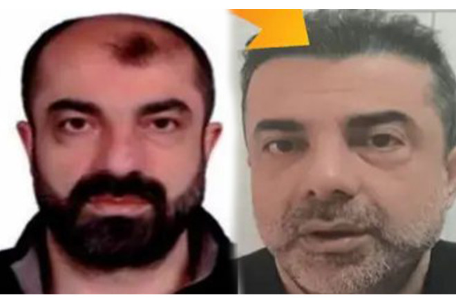 Estetik əməliyyatlarla 7 il gizlənə bildi - FOTO