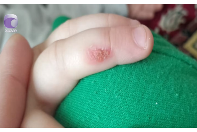 “3 yaşlı uşağım bağçada ağlayanda bıçağı qızdıraraq əlinə basıb” - VİDEO + YENİLƏNİB