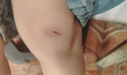 “4-cü sinif şagirdi nəvəmi məktəbin ayaqyolunda döyüb” - FOTOLAR