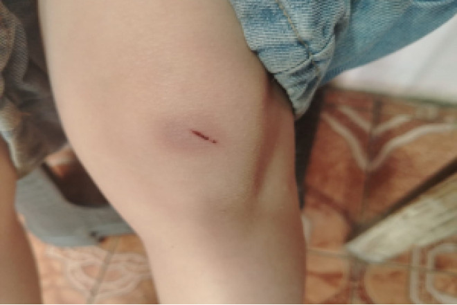 “4-cü sinif şagirdi nəvəmi məktəbin ayaqyolunda döyüb” - FOTOLAR