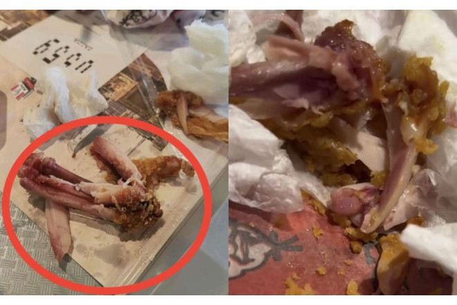 KFC Bakıda müştərilərə qanlı toyuq satır? - AÇIQLAMA