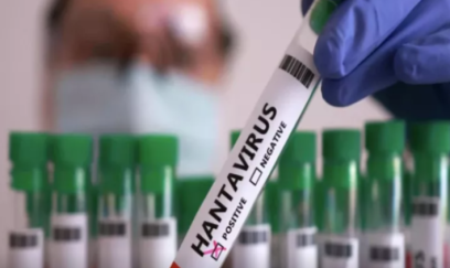 Dünyanı təşvişə salan Hantavirus nədir? - ƏLAMƏTLƏRİ