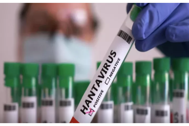 Dünyanı təşvişə salan Hantavirus nədir? - ƏLAMƏTLƏRİ
