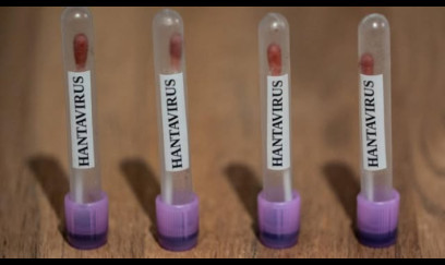Hantavirus yayılır? - Avropada ciddi xəbərdarlıq